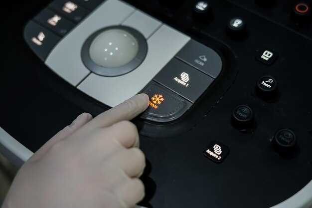 Разбор кнопок на рычаге: OD ON/OFF, OD MANU и POWER